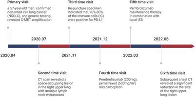 I-125 seeds brachytherapy combined with immunotherapy for MET amplification in non-small cell lung cancer from clinical application to related lncRNA mechanism explore: a case report